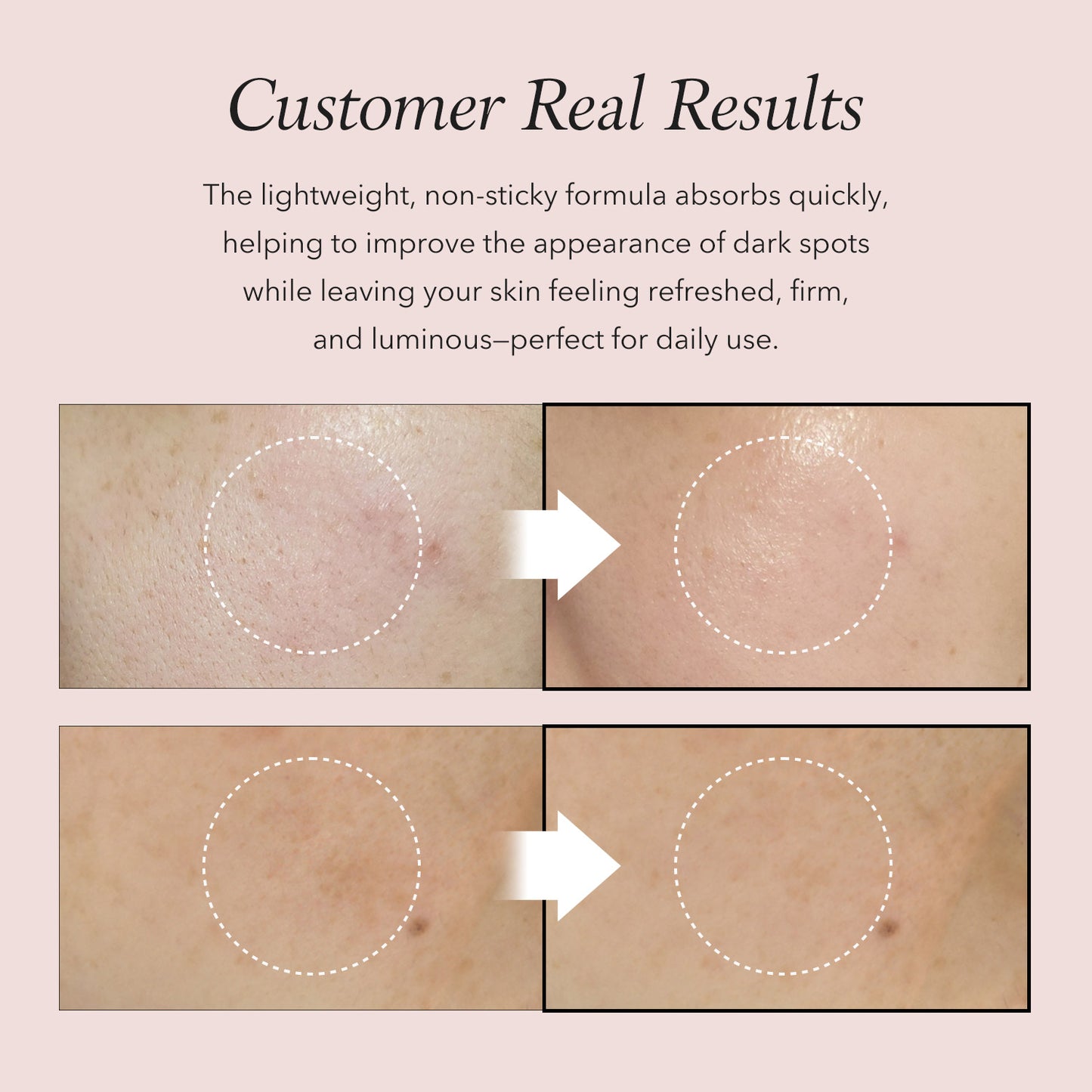 Pink Aloe Mucin Serum