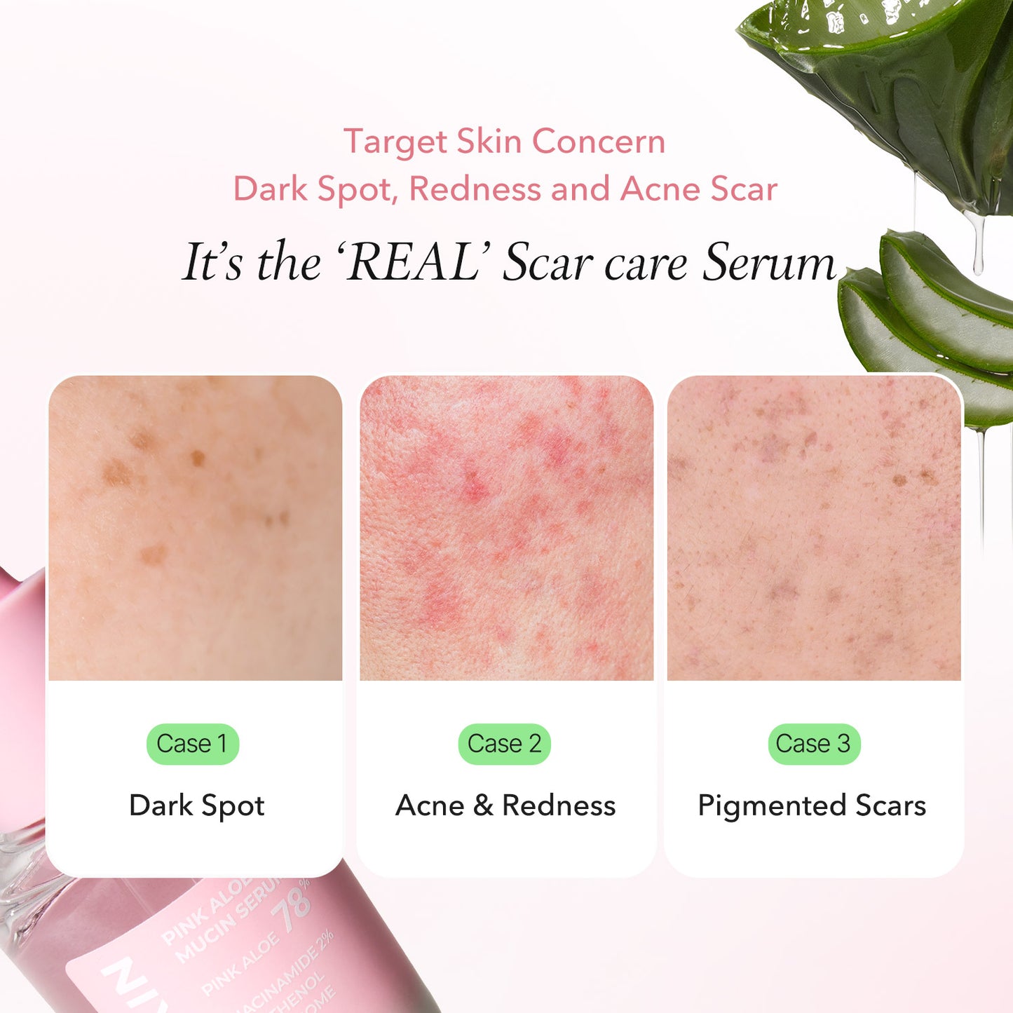 Pink Aloe Mucin Serum