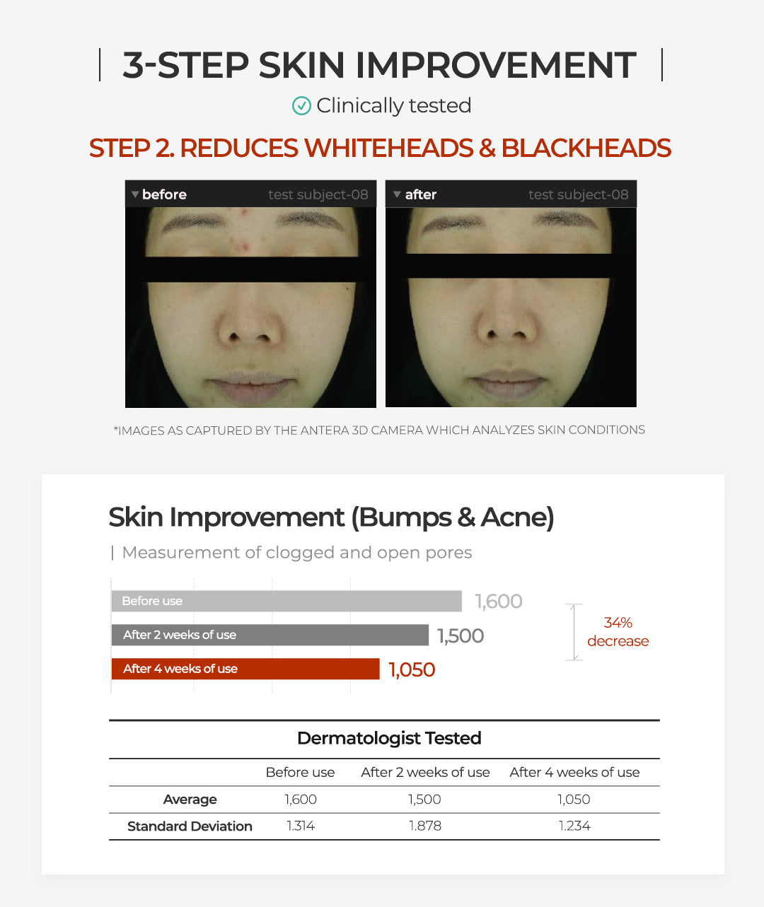 Real Carrotene Full Line Set (Free gifts + Free shipping) - APRILSKIN SG