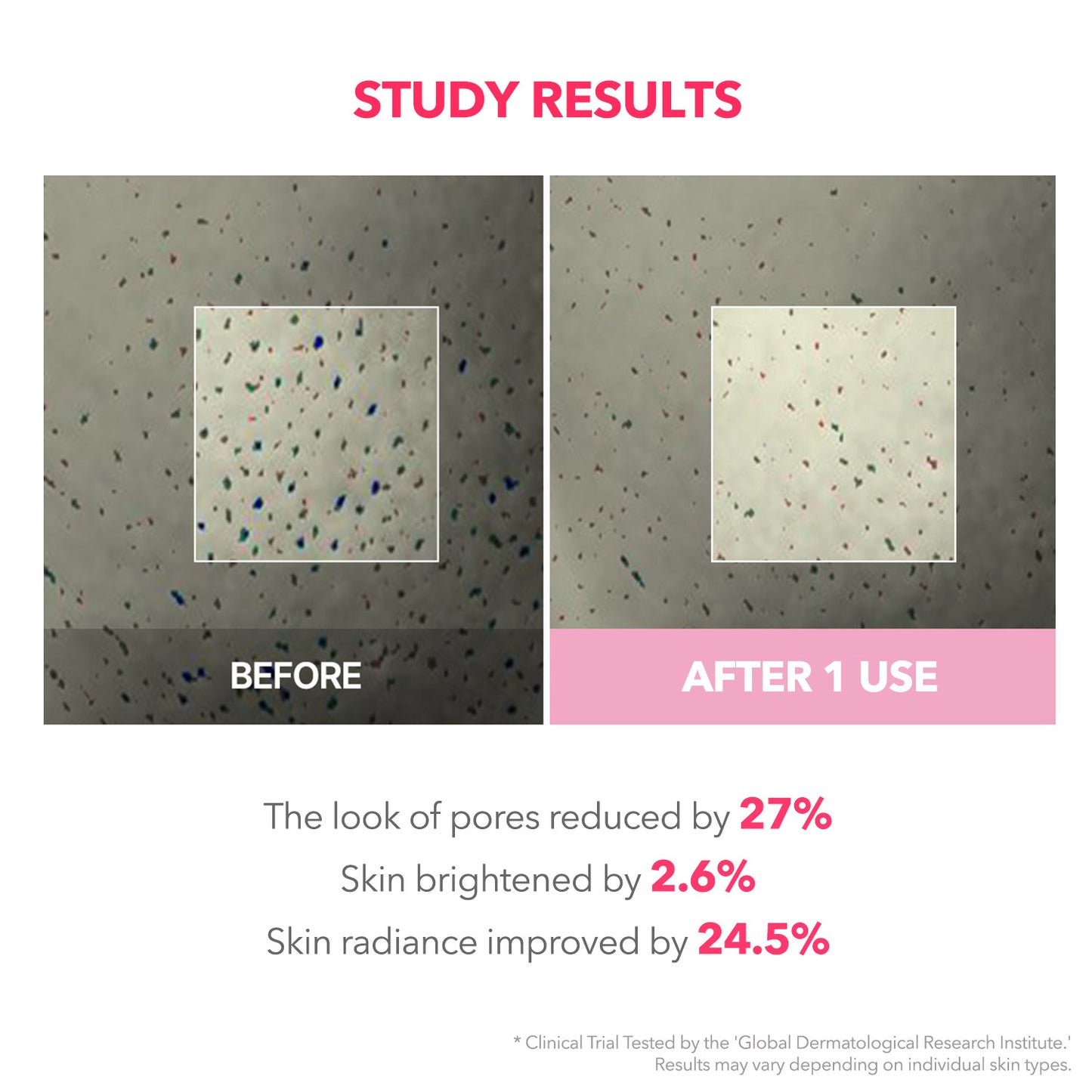 TXA Niacinamide 99 Overnight Wrapping Mask - APRILSKIN SG