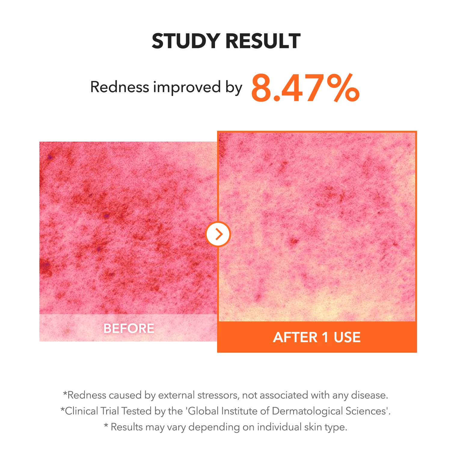 Carrotene IPMP™ Clearing Solution - APRILSKIN SG