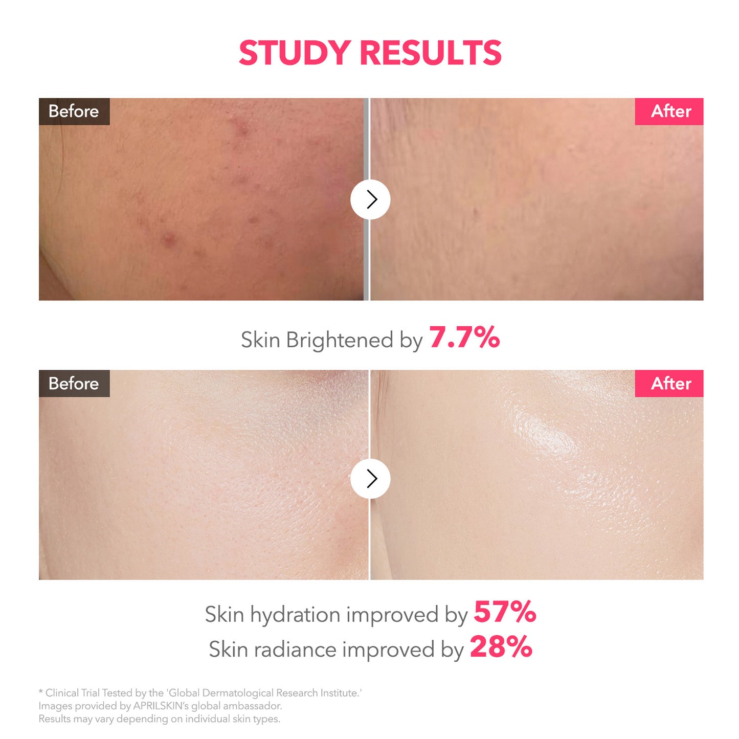 TXA Pink Capsule Overnight Gel Mask - APRILSKIN SG