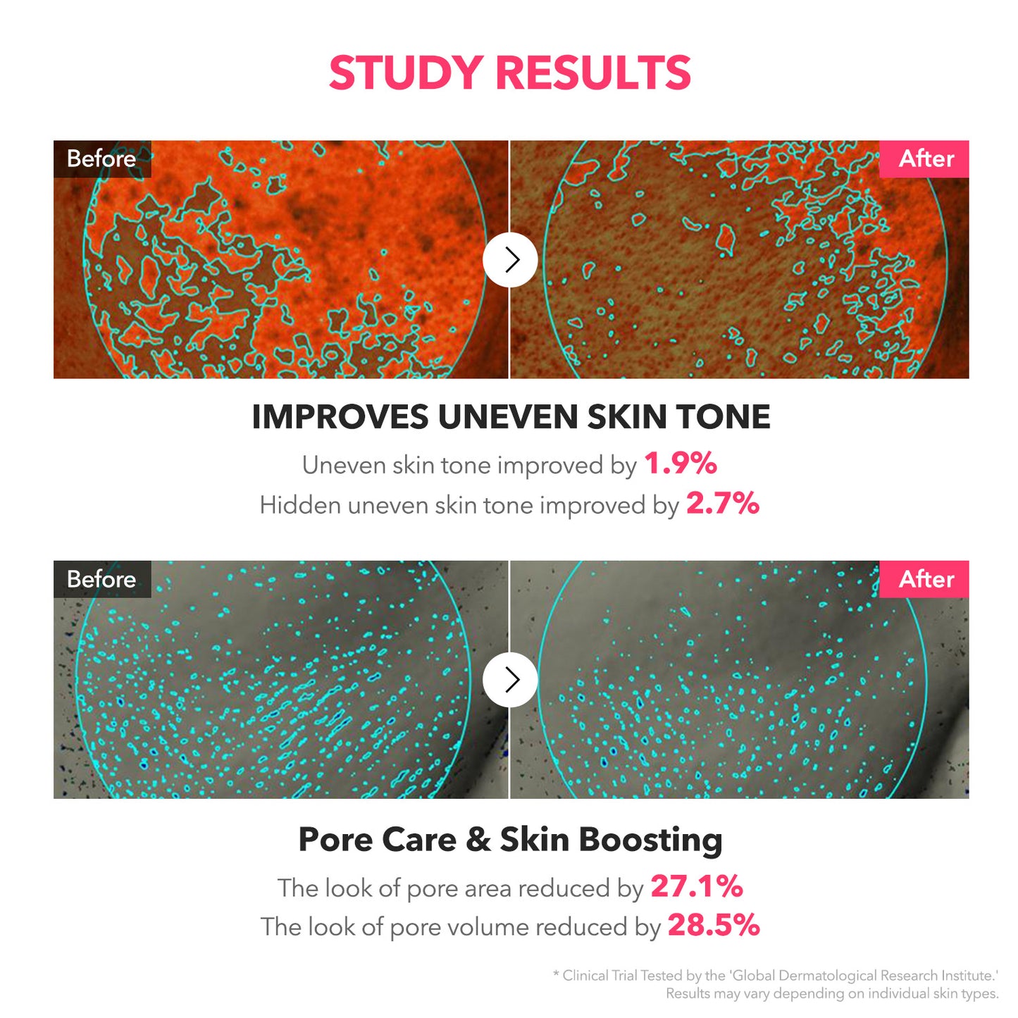 TXA Niacinamide Toning Shot 99 Spicule Serum - APRILSKIN SG