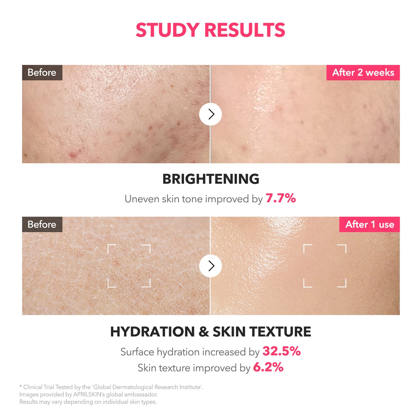 TXA+Niacinamide 99 Pink Milky Toner - APRILSKIN SG